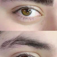 آموزش میکرووفیبروزبامدرک