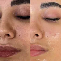 فیشال و(پاکسازی پوست)آبرسانی پوست|خدمات آرایشگری و زیبایی|رفسنجان, |دیوار