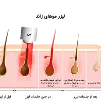 هنوز دنبال مرکز لیزری|خدمات آرایشگری و زیبایی|بم, |دیوار