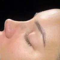 عمل جراحی زیبایی بینی،ترمیم بینی،صورت،اندام|خدمات زیبایی و سلامت|تهران, تهرانپارس غربی|دیوار
