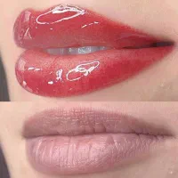 میکروبلید و شیدلب