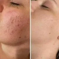 محصولات مراقبتی پوست و مو و سلامت بدن
