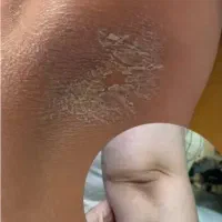 رفع تیرگی،آلگاپیل،لک صورت، پرسینگ، ژل صورت|خدمات آرایشگری و زیبایی|شیراز, سلطان آباد|دیوار