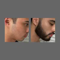 توی ۲۵ روز ریش دار شو