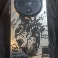 گوشی POCOC70حافظه256رم8