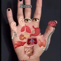 زالو فصد حجامت طب سوزنی طب سنتی بادکش گرم و سرد