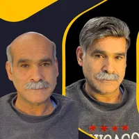 مرکز تخصصی پروتزمو /ترمیم مو در اصفهان|خدمات آرایشگری و زیبایی|اصفهان, خرم|دیوار