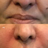 همکاری با لیدر عرب ۵۰ درصد بازاریاب( مشتری یاب)|استخدام درمانی، زیبایی، بهداشتی|مشهد, مصلی (کارمندان اول)|دیوار