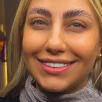 کامپوزیت لمینت حرفه ای