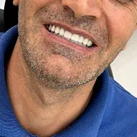 دندانسازی آوا قرارداد مستقیم کلیه بیمه ها