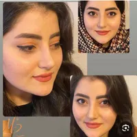 جشنواره تخفیفات تابستانه جراحی بینی،صورت،پیکرتراشی|خدمات آرایشگری و زیبایی|کرج, مهرویلا جنوبی|دیوار