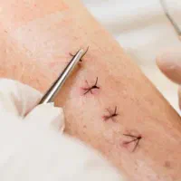 خدمات پرستاری در منزل|خدمات آرایشگری و زیبایی|نیشابور, بزرگمهر|دیوار