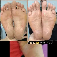 یه لحظه رد نکن بیا ببین پدیکور پارو