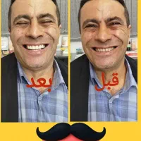 دندانسازی (دندان مصنوعی)