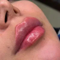 جشنواره لیفت تخصصی صورت با نخ و کانتورینگ|خدمات آرایشگری و زیبایی|بروجرد, |دیوار