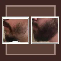 تضمینِ رویش
