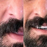 دندانسازی مصنوعی دندان مصنوعی با کیفیت و زیبا|خدمات آرایشگری و زیبایی|تبریز, |دیوار