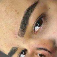 تخفیف ویژه میکرووژل بوتاکس|خدمات آرایشگری و زیبایی|بیرجند, |دیوار