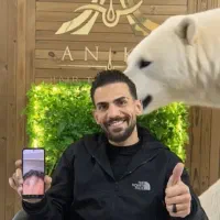 کاشت مو و ابرو با استاندارهای بین المللی