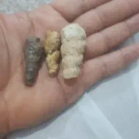 انواع عرج
