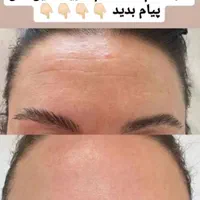 سرم لیفتینگ گاتیو(سرم بوتاکس-کرم بوتاکس)|آرایشی، بهداشتی، درمانی|شیراز, چوگیاه‎|دیوار