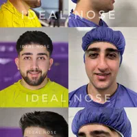 جراحی بینی با شرایط تخفیفی و اقساطی