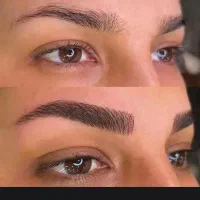 میکرو فیبروز و ارایش داعم تخفیف فقط تا اخر هفته