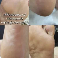 تخفیف ویژه ناخن و پدیکور|خدمات آرایشگری و زیبایی|کرج, اتحاد|دیوار