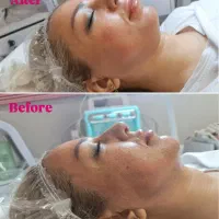 مزونیدلینگ تخصصی با۳۰٪تخفیف ویژه درمطب پزشک|خدمات آرایشگری و زیبایی|اصفهان, جلفا|دیوار