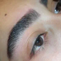 میکروبلیدینگ وفیبروز وشیدینگ لب