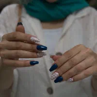 کاشت و ترمیم ناخن ونک