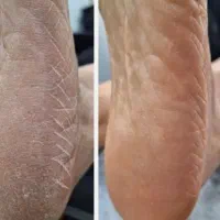 مدل ناخن بافت پدیکور مژه|خدمات آرایشگری و زیبایی|اندیشه, اندیشه فاز ۱|دیوار