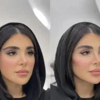 بوتاکس فیلر مزو تراپی لیفت بینی و صورت بلفارو