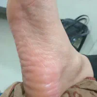 فروش وسایل پدیکور|آرایشی، بهداشتی، درمانی|اسلامآباد غرب, |دیوار