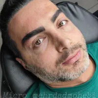 میکروبلیدینگ آقایان/ شیدینگ لب/میکرو اسکالپ سر|خدمات زیبایی و سلامت|اصفهان, مرداویج|دیوار