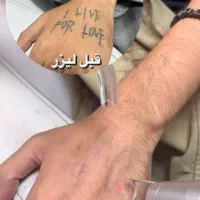 لیزر تتو ،ریمو،مربن تراپی ،خالبرداری|خدمات آرایشگری و زیبایی|شیراز, قصرالدشت|دیوار