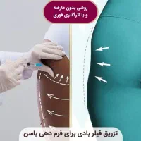 فیلر بادی در رشت