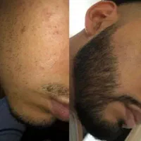 تغییر رو لمس کن|آرایشی، بهداشتی، درمانی|تهران, شهرک ابوذر|دیوار