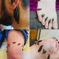 دیسک سیاتیک فیزیوتراپی کاردرمانی زالو درمانی حجامت|خدمات آرایشگری و زیبایی|تهران, ارامنه|دیوار
