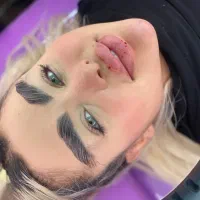 کیلینیک تخصصی ژل لب کات گونه زاویه فک