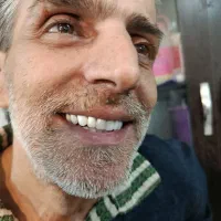 دندان مصنوعی طرح لمینیت|خدمات زیبایی و سلامت|تهران, فیروزآبادی|دیوار