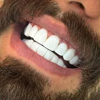 باعکسOPG،بیمه تکمیلی سامان ویاچک صیادی مراجعه کنید|خدمات آرایشگری و زیبایی|بم, |دیوار