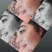 جشنواره تزریق ژل بدون درد و کبودی تضمینی|خدمات آرایشگری و زیبایی|جیرفت, |دیوار