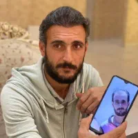 کاشت مو وابرو|خدمات آرایشگری و زیبایی|سقز, |دیوار