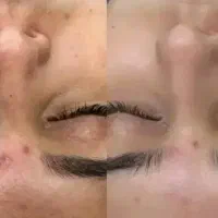 پاکسازی صورت وبدن