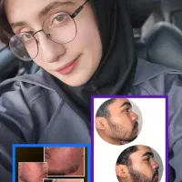 رویش ریش و مو در ۳۰ روز(کارت ضمانت)