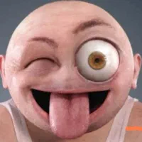 انفجار چشم و شکم از شدت خنده