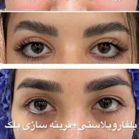 تخفیف ویژه فقط تا جمعه