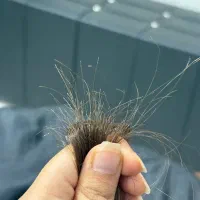 موخوره گیری روسی با شامپو ضد موخوره رایگان