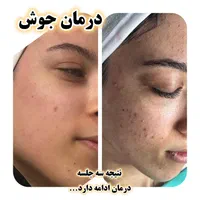 آموزش و خدمات پاکسازی پوست چالوس|خدمات آرایشگری و زیبایی|چالوس, |دیوار